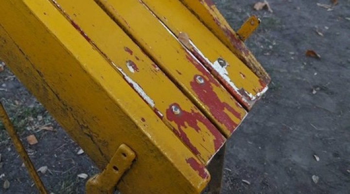 NIÑO LASTIMADO POR IMPERDONABLE DESCUIDO EN UN TOBOGÁN DEL PARQUE 